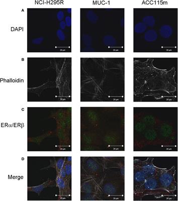 Cytotoxic Effect of Progesterone, Tamoxifen and Their Combination in Experimental Cell Models of Human Adrenocortical Cancer